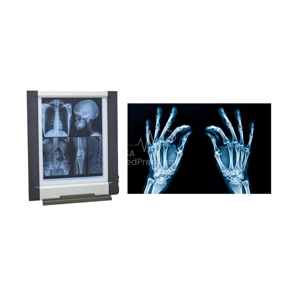 X-Ray