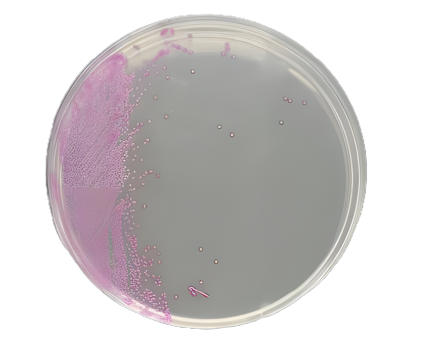 Culture Media HardyCHROM™ Staph Aureus Mono-plate Format
