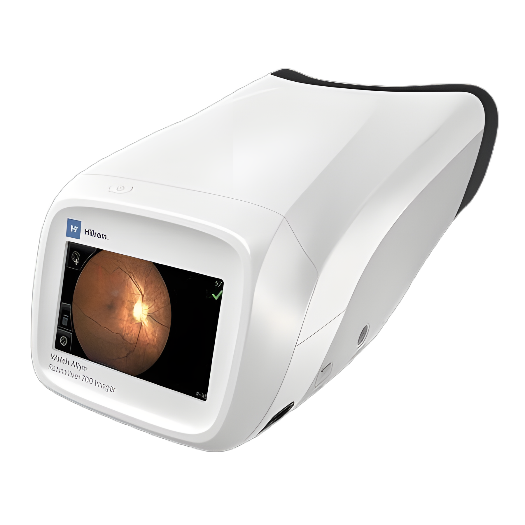 Retial Screening Machine Welch Allyn RetinaVue 700 Imager for Glaucoma & Retinal Screening