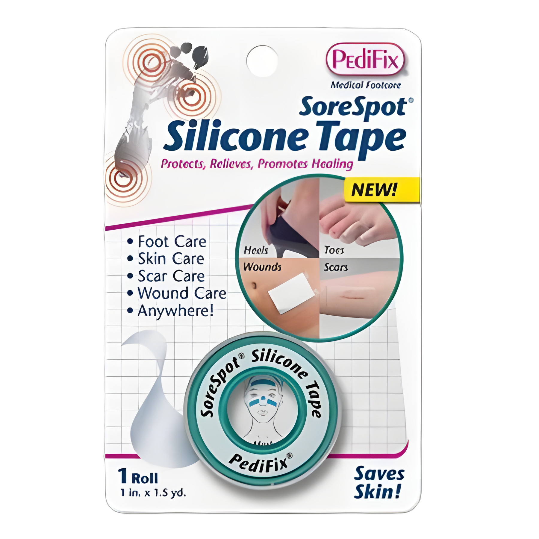 Waterproof Silicone Medical Tape - Sore Spot® 1x1.5 Yard