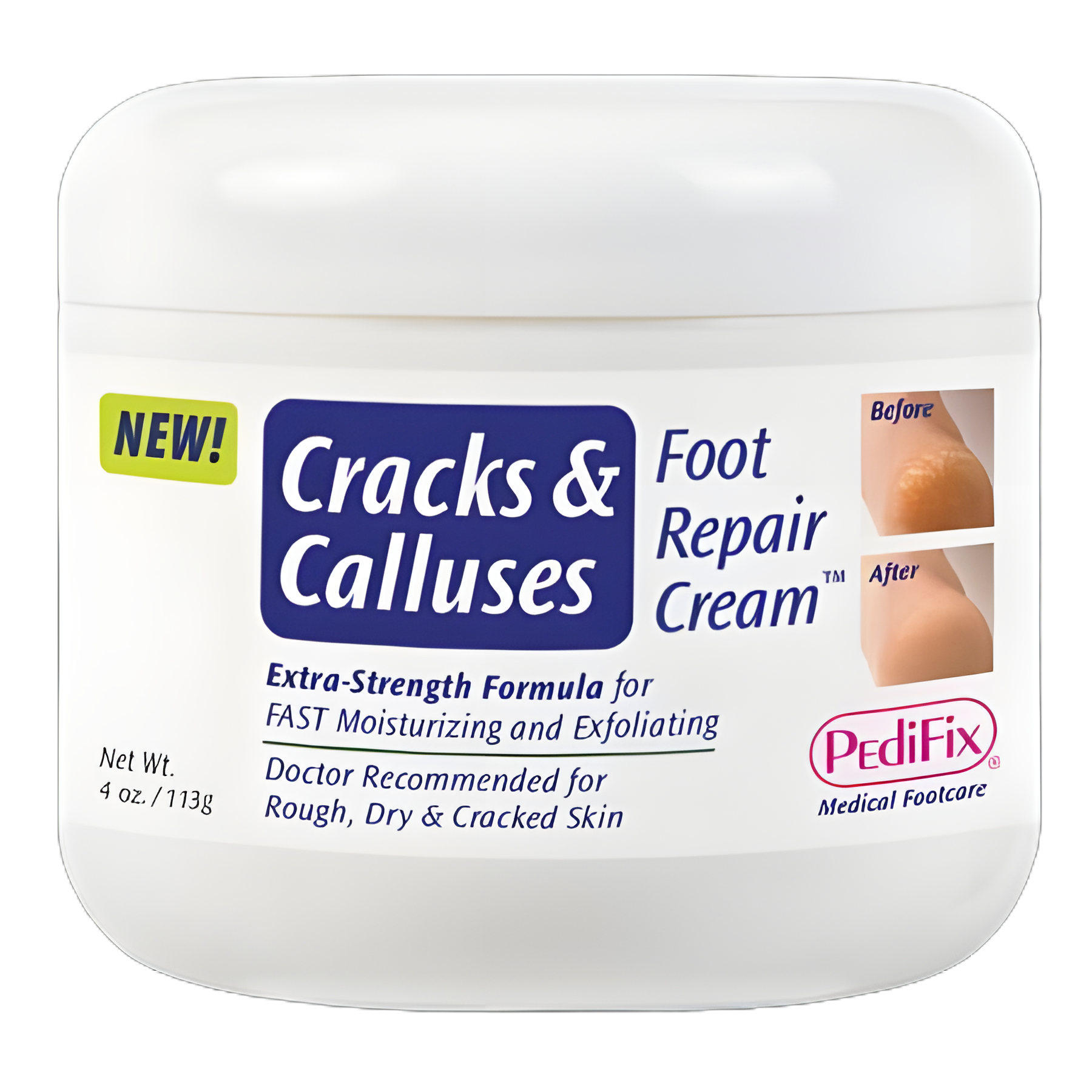 Foot Moisturizer PediFix® Cracks & Calluses 4 oz. Jar Scented Cream