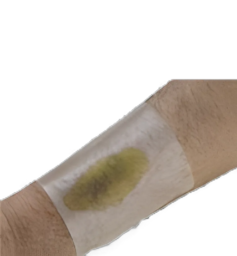 Hydrocolloid Dressing Excel 3-3/5 X 4 Inch Sacral