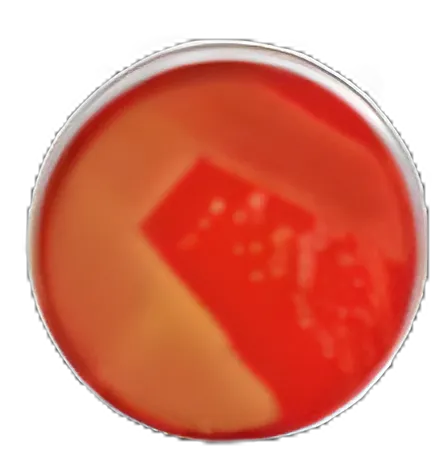 https://usmed-media.usamedpremium.com/public/assets/Catalog/Images/USAMP-65847821.webp