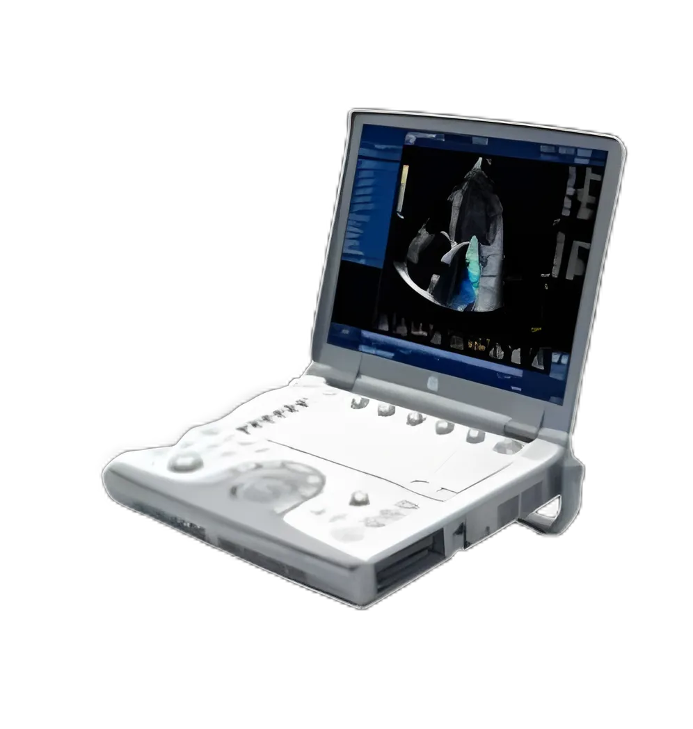 Refurbished Ultrasound System Voluson® 730 Power: Max 1010 VA with on-board peripherals