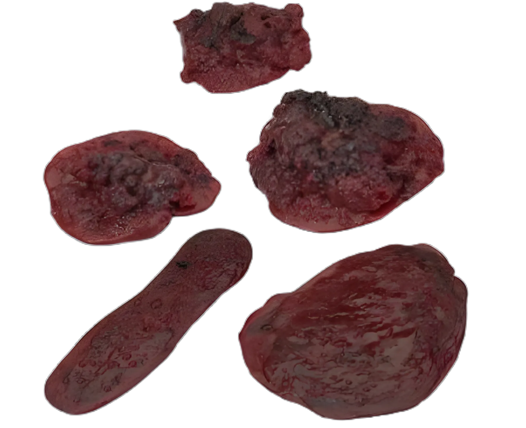 Life/form® Clots & Hemorrhages Training Set