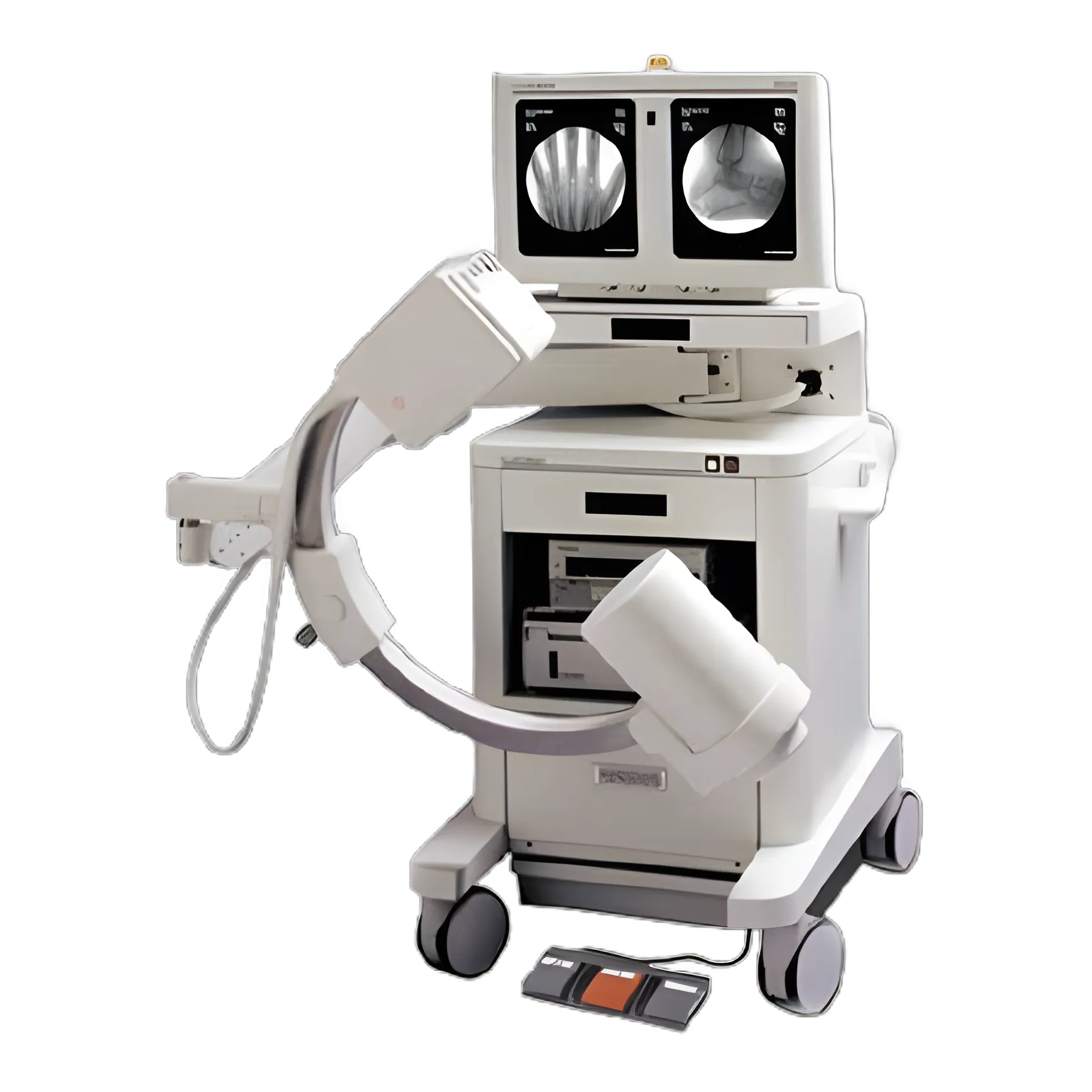 Refurbished Hologic Mini C-Arm for Extremity Imaging