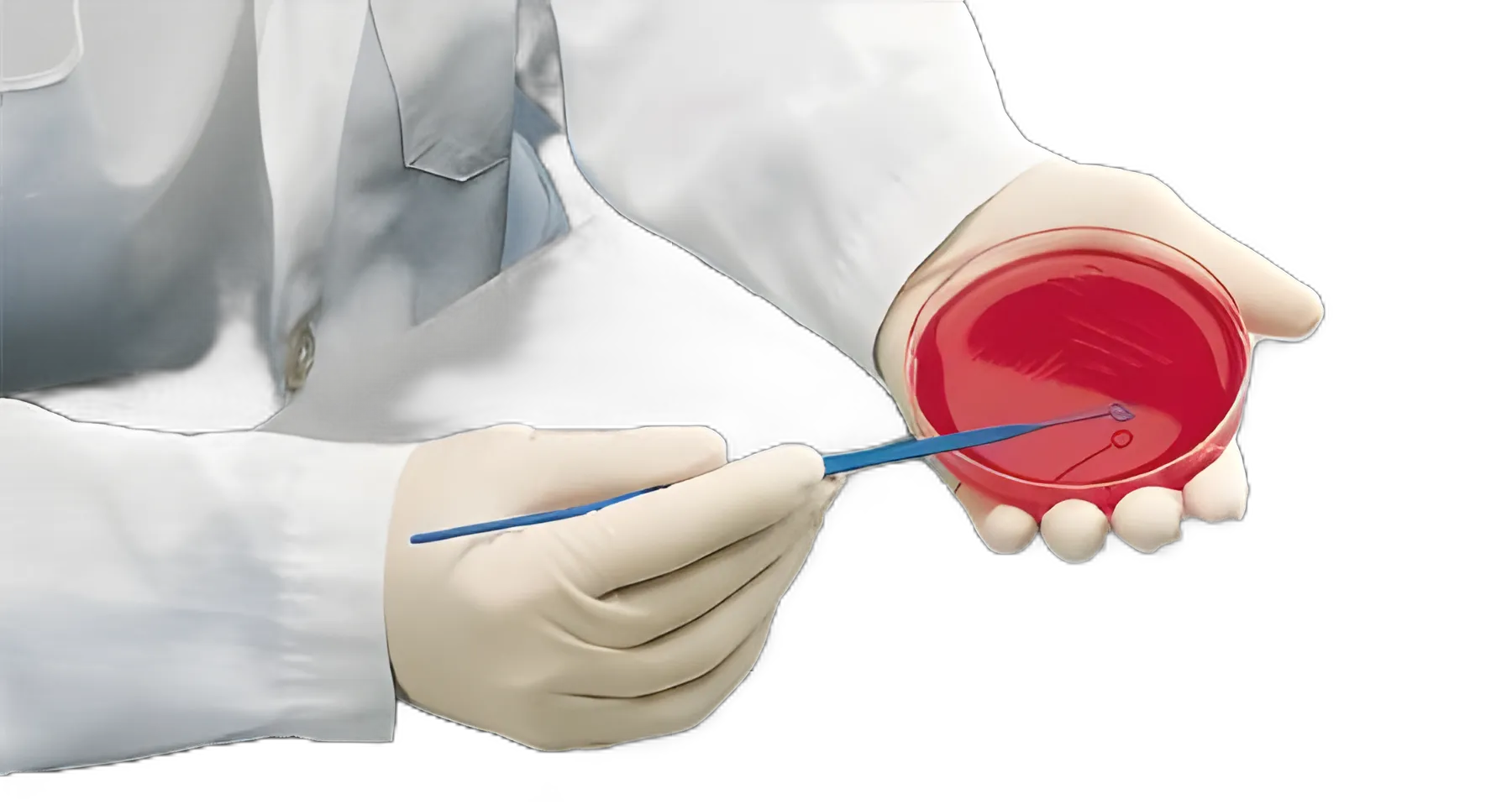 BD Difco™ Inoculating Loop 10 μL with Integrated Handle - Sterile, Plastic