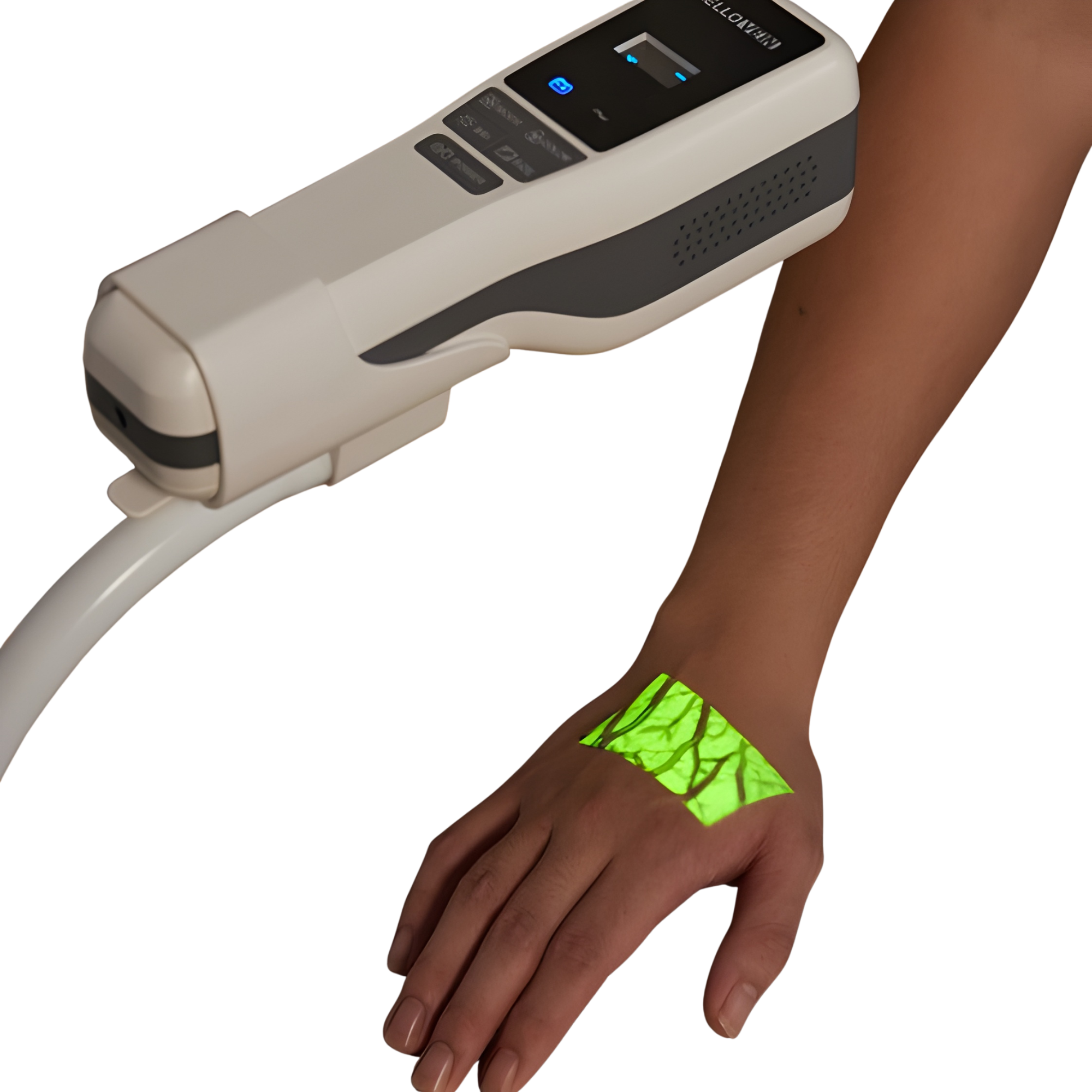 Lite 2.0 + Stand, Handheld Portable Infrared Vein Finder with Desktop Stand, 1/EA